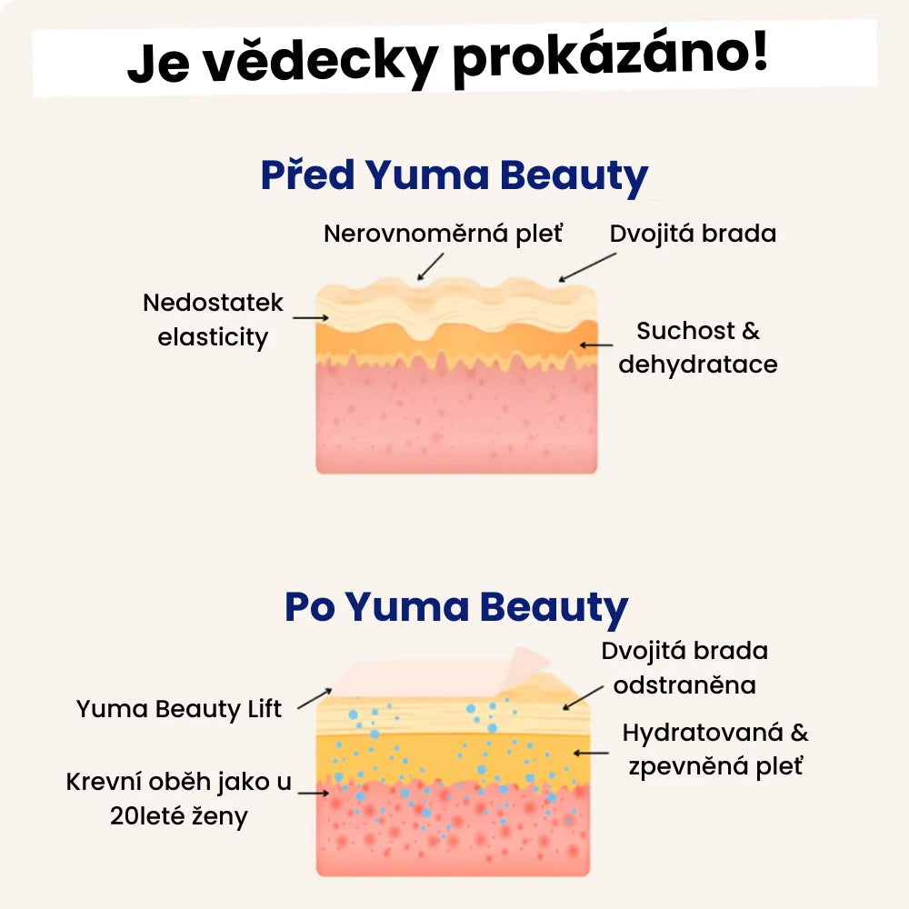 Yuma Beauty™ Lift : Rozlučte se se svým podbradkem ještě dnes