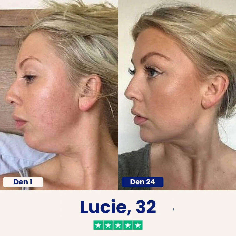 Yuma Beauty™ Lift : Rozlučte se se svým podbradkem ještě dnes