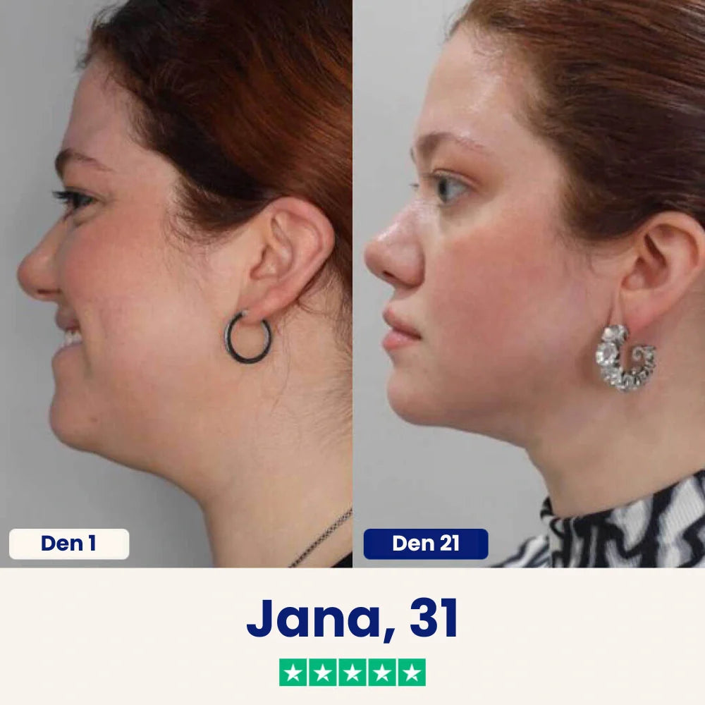Yuma Beauty™ Lift : Rozlučte se se svým podbradkem ještě dnes.