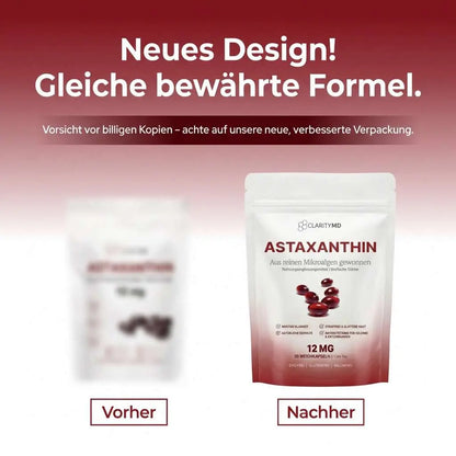 KlarsichtMD Astaxanthin – Bekämpft oxidativen Stress auf natürliche Weise, um das Gleichgewicht von innen und außen wiederherzustellen.